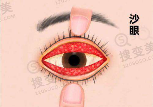 郑州爱尔眼科医院电话是多少?400 电话抄公布 1 地址+预约挂号方式一键收藏——总结与建议